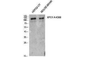 Image no. 2 for anti-Exportin 1 (XPO1) (acLys568) antibody (ABIN3188006)