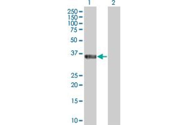 Copine V antibody  (AA 1-301)