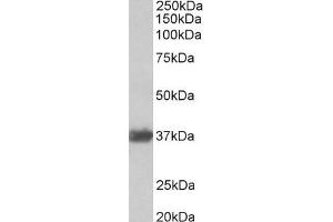 Image no. 2 for anti-Glyceraldehyde-3-Phosphate Dehydrogenase (GAPDH) (Internal Region) antibody (ABIN185543)