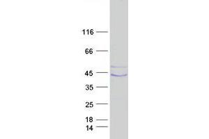 Image no. 1 for Plasminogen Activator, Urokinase Receptor (PLAUR) (Transcript Variant 1) protein (Myc-DYKDDDDK Tag) (ABIN2713801)