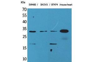 Image no. 1 for anti-Fibroblast Growth Factor 18 (FGF18) (C-Term) antibody (ABIN3187720)