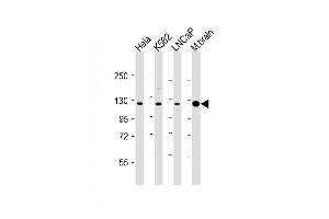 Image no. 3 for anti-Lysine (K)-Specific Demethylase 4C (KDM4C) (AA 1023-1056), (C-Term) antibody (ABIN655391)