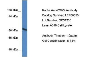 Image no. 1 for anti-Zinc Finger, MIZ-Type Containing 2 (ZMIZ2) (Middle Region) antibody (ABIN2788517)