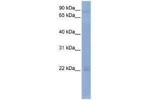 Image no. 1 for anti-2'-5'-Oligoadenylate Synthetase 2, 69/71kDa (OAS2) (Middle Region) antibody (ABIN2779107)