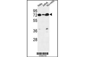 Image no. 1 for anti-Lipid Phosphate Phosphatase-Related Protein Type 4 (LPPR4) antibody (ABIN2444968)