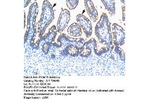 Image no. 1 for anti-Tripartite Motif Containing 15 (TRIM15) (N-Term) antibody (ABIN2775930)