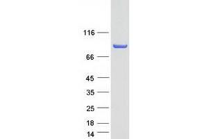 Image no. 1 for Golgi-Associated, gamma Adaptin Ear Containing, ARF Binding Protein 3 (GGA3) protein (Myc-DYKDDDDK Tag) (ABIN2721858)