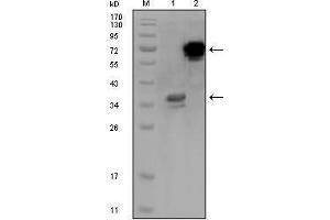 Image no. 1 for anti-Hermansky-Pudlak Syndrome 1 (HPS1) antibody (ABIN969198)