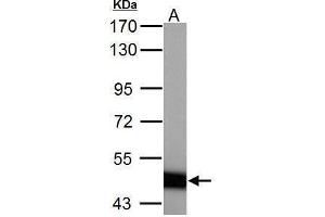 Image no. 3 for anti-4-Aminobutyrate Aminotransferase (ABAT) (C-Term) antibody (ABIN2854328)