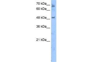 Image no. 1 for anti-Membrane Bound O-Acyltransferase Domain Containing 7 (MBOAT7) (C-Term) antibody (ABIN2783918)