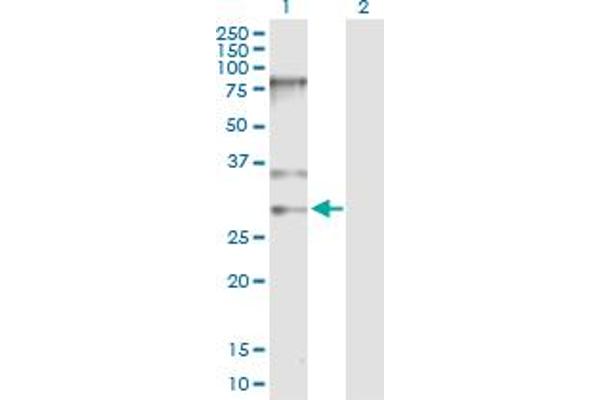 SNRPB 抗体  (AA 1-240)