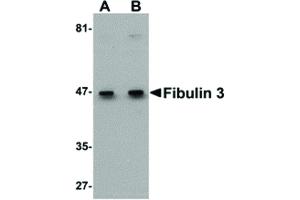 Image no. 1 for anti-Fibulin 3 (FBLN3) (C-Term) antibody (ABIN6656581)