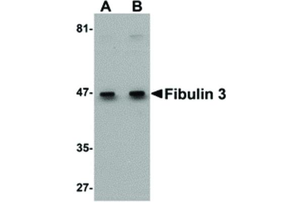 anti-Fibulin 3 (FBLN3) (C-Term) antibody