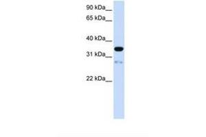 Image no. 1 for anti-Transmembrane Protein 38A (TMEM38A) (AA 74-123) antibody (ABIN6738623)