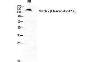 Image no. 2 for anti-Notch 2 (NOTCH2) (Asp1733), (cleaved) antibody (ABIN3181821)