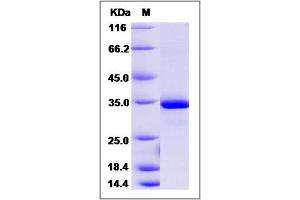 Image no. 1 for Esterase D (ESD) (AA 1-282), (Mature) protein (His tag) (ABIN2006110)