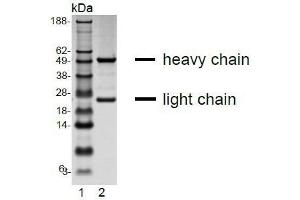 Image no. 4 for anti-Interleukin 13 Receptor, alpha 1 (IL13RA1) (Extracellular Domain) antibody (ABIN108718)