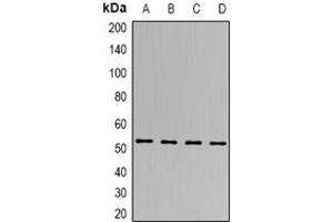Image no. 2 for anti-tRNA-splicing Endonuclease Subunit SEN2 (TSEN2) (full length) antibody (ABIN6006210)