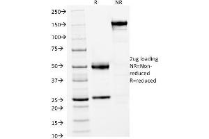 Image no. 4 for anti-Forkhead Box A1 (FOXA1) (AA 372-472) antibody (ABIN6939651)