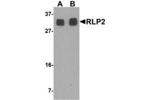 Image no. 2 for anti-Rab Interacting Lysosomal Protein-Like 2 (RILPL2) (Middle Region) antibody (ABIN1450146)