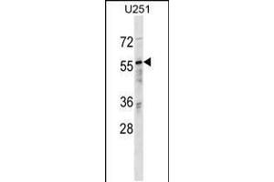 Image no. 1 for anti-RAN Binding Protein 3 (RANBP3) (AA 26-55), (N-Term) antibody (ABIN5532009)