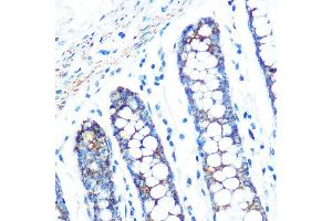 SFRP4 antibody