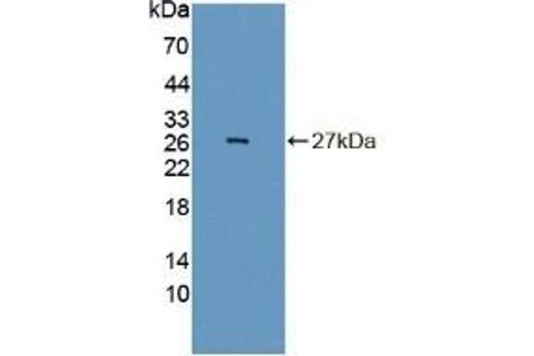 INSM1 antibody  (AA 278-518)