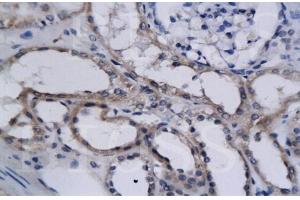 Image no. 1 for anti-Endothelial PAS Domain Protein 1 (EPAS1) (AA 1-130) antibody (ABIN686662)