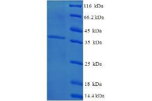 Image no. 1 for Cysteine and Glycine-Rich Protein 3 (CSRP3) (AA 1-194), (full length) protein (His-SUMO Tag) (ABIN5709347)