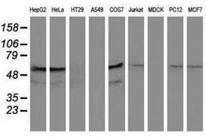 Image no. 1 for anti-Katanin P60 Subunit A-Like 1 (KATNAL1) antibody (ABIN1498985)