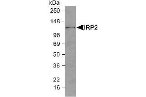 Image no. 2 for anti-Iron-Responsive Element Binding Protein 2 (IREB2) (N-Term) antibody (ABIN363496)