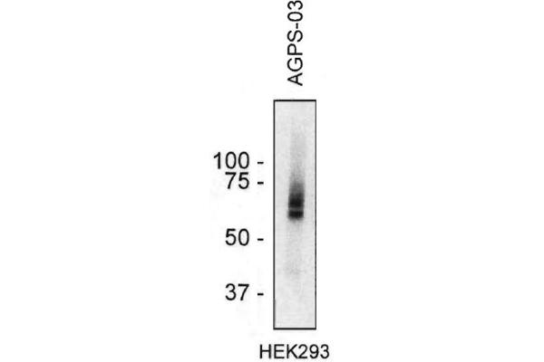 anti-Alkylglycerone Phosphate Synthase (AGPS) (AA 158-384) antibody