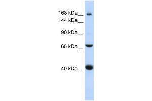 Image no. 1 for anti-ATP-Binding Cassette, Sub-Family C (CFTR/MRP), Member 9 (ABCC9) (Middle Region) antibody (ABIN2781513)