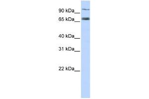 Image no. 1 for anti-Transporter 1, ATP-Binding Cassette, Sub-Family B (MDR/TAP) (TAP1) (Middle Region) antibody (ABIN2781498)