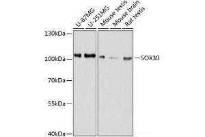 Western blot analysis of extracts of various cell lines using SOX30 Polyclonal Antibody at dilution of 1:1000.