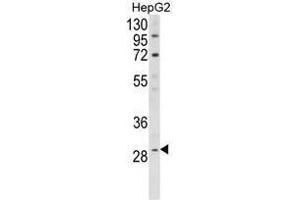 Image no. 1 for anti-Deiodinase, Iodothyronine, Type I (DIO1) (AA 36-66), (N-Term) antibody (ABIN452912)
