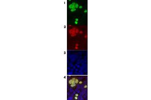 Immunofluorescence of cells expressing GFP tagged protein.