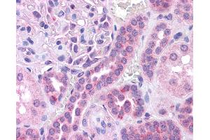 Image no. 2 for anti-V-Maf Musculoaponeurotic Fibrosarcoma Oncogene Homolog (Avian) (MAF) (N-Term) antibody (ABIN2780675)
