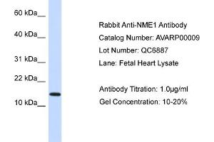 Image no. 3 for anti-Non-Metastatic Cells 1, Protein (NM23A) Expressed in (NME1) (N-Term) antibody (ABIN2792090)