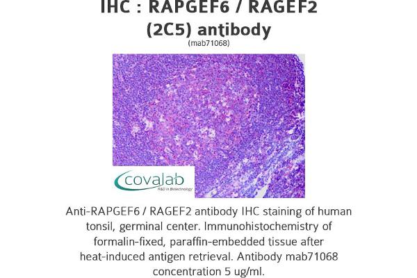 anti-Rap Guanine Nucleotide Exchange Factor (GEF) 6 (RAPGEF6) (AA 1012-1111) antibody