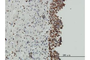 Image no. 1 for anti-Ewing Sarcoma Breakpoint Region 1 (EWSR1) (AA 358-453) antibody (ABIN560815)