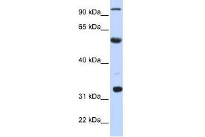 Image no. 1 for anti-Apolipoprotein B mRNA Editing Enzyme, Catalytic Polypeptide 1 (APOBEC1) (N-Term) antibody (ABIN2778780)