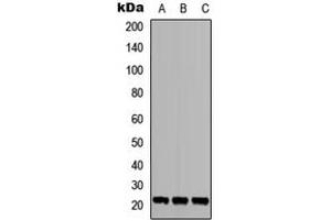 Image no. 1 for anti-TGFB-Induced Factor Homeobox 2-Like, Y-Linked (TGIF2LY) (C-Term) antibody (ABIN2705290)