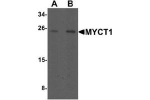 Image no. 1 for anti-Myc Target 1 (MYCT1) (C-Term) antibody (ABIN1449981)