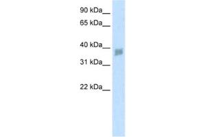 Image no. 1 for anti-Small Nuclear RNA Activating Complex, Polypeptide 3, 50kDa (SNAPC3) antibody (ABIN2460881)