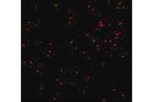 Image no. 2 for anti-Endoplasmic Reticulum To Nucleus Signaling 1 (ERN1) (N-Term) antibody (ABIN6657003)