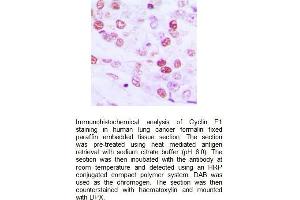 Image no. 3 for anti-Cyclin E1 (CCNE1) (Center) antibody (ABIN2487035)