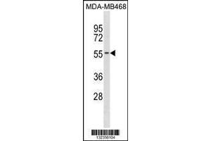 Image no. 1 for anti-Potassium Channel Subfamily K Member 6 (KCNK6) (AA 263-292), (C-Term) antibody (ABIN1881475)