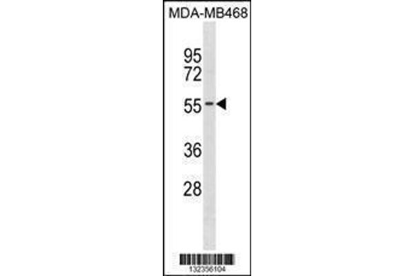 anti-Potassium Channel Subfamily K Member 6 (KCNK6) (AA 263-292), (C-Term) antibody