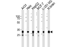 Image no. 2 for anti-Cytochrome C1 (CYC1) (AA 142-176) antibody (ABIN1944852)